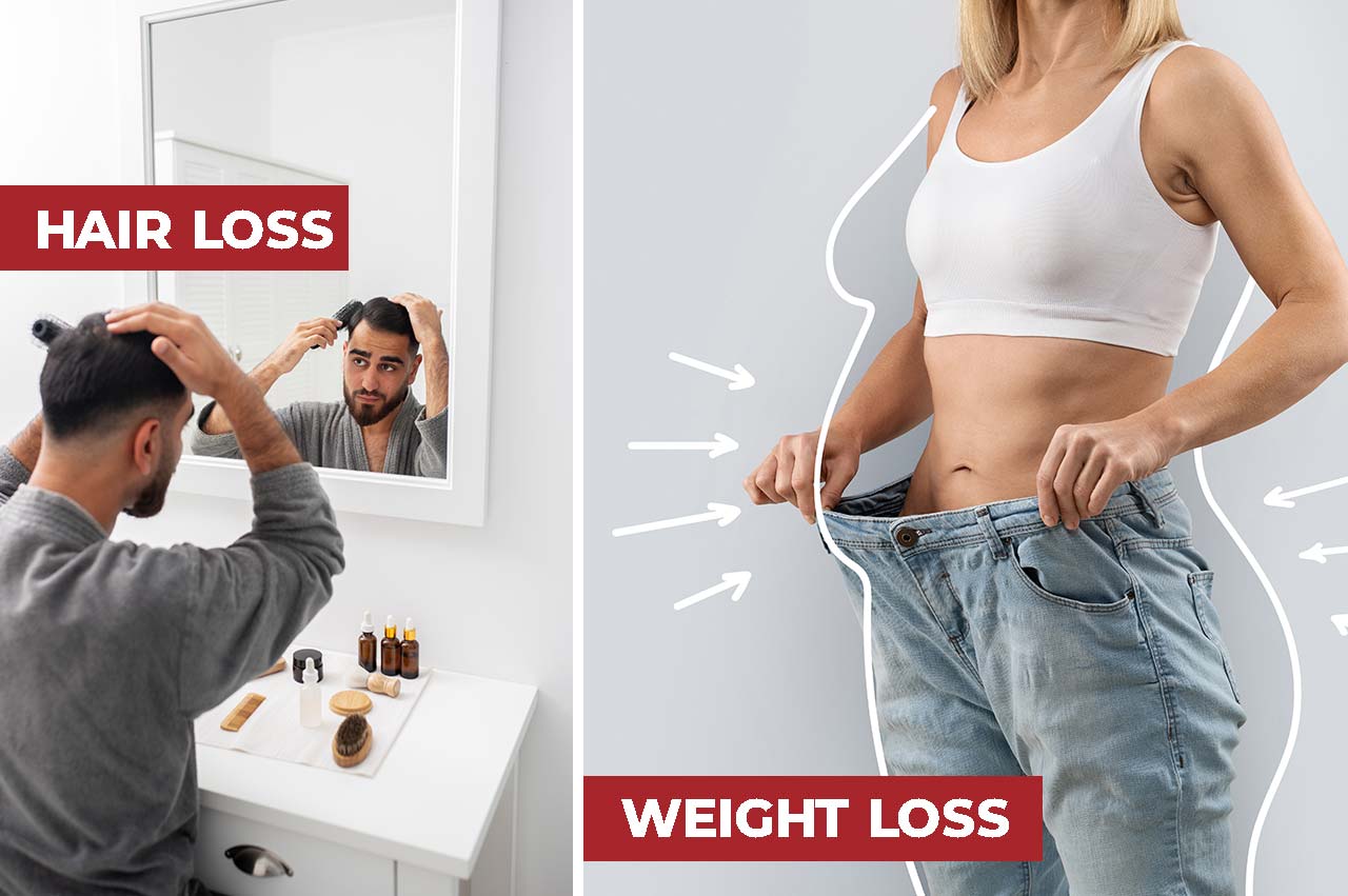 Hair Loss and Weight Loss Services at Our Center in Bardonia