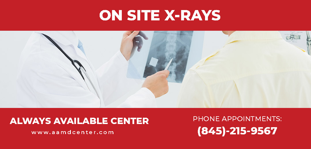 X-Rays 